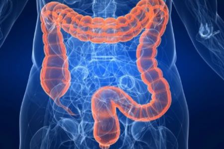 Tres de cada cuatro pacientes con intestino irritable padece síntomas durante al menos cinco años