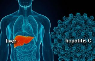 ARTÍCULO :: Avances e innovaciones en los nuevos tratamientos contra la Hepatitis C   