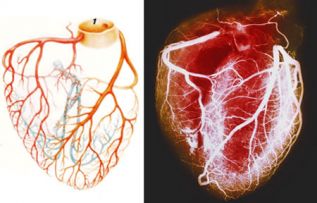 Se estima que en 2030 enfermedades del corazón provocarán más de 23 millones de fallecimientos en el mundo